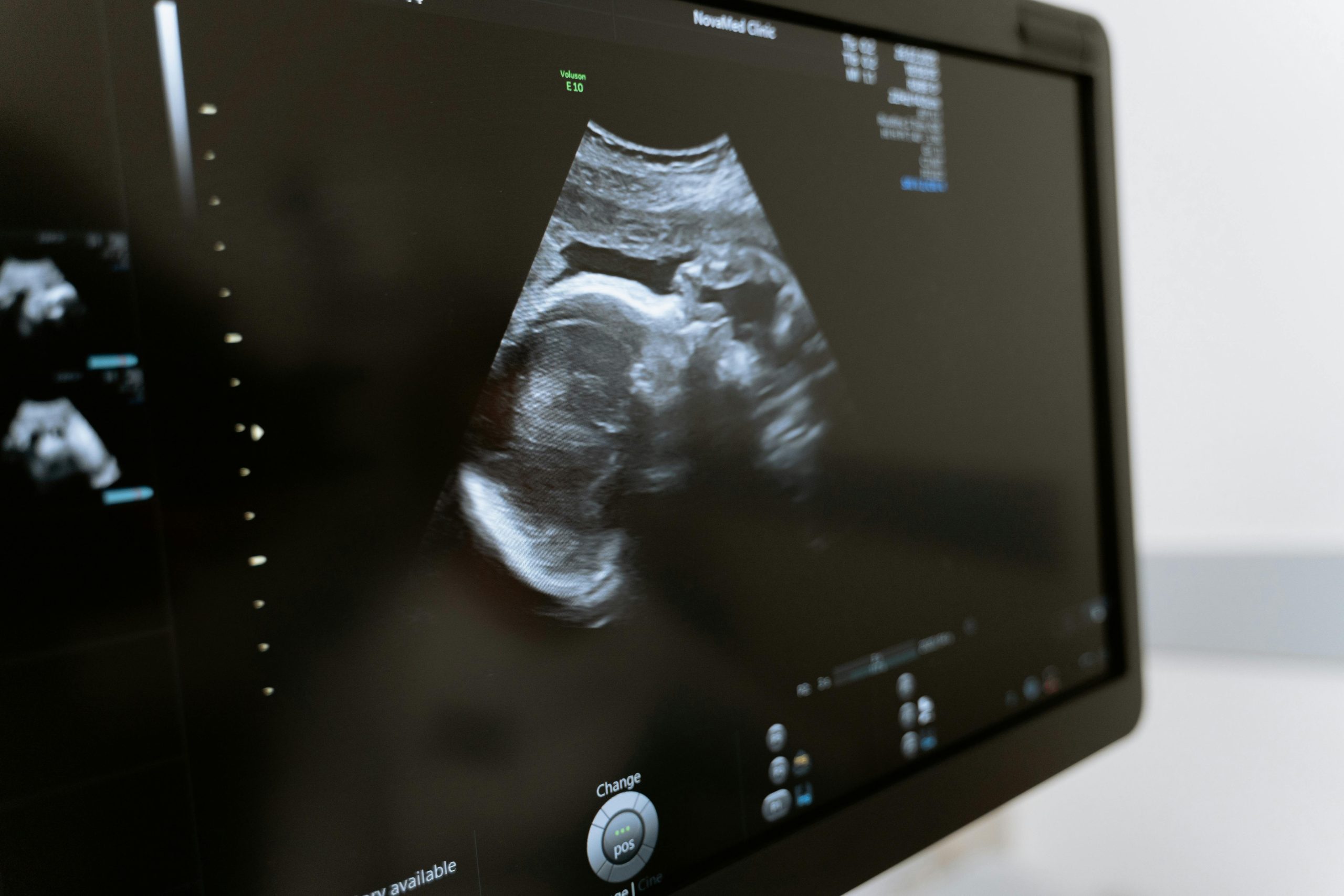 Growth Scan 2D